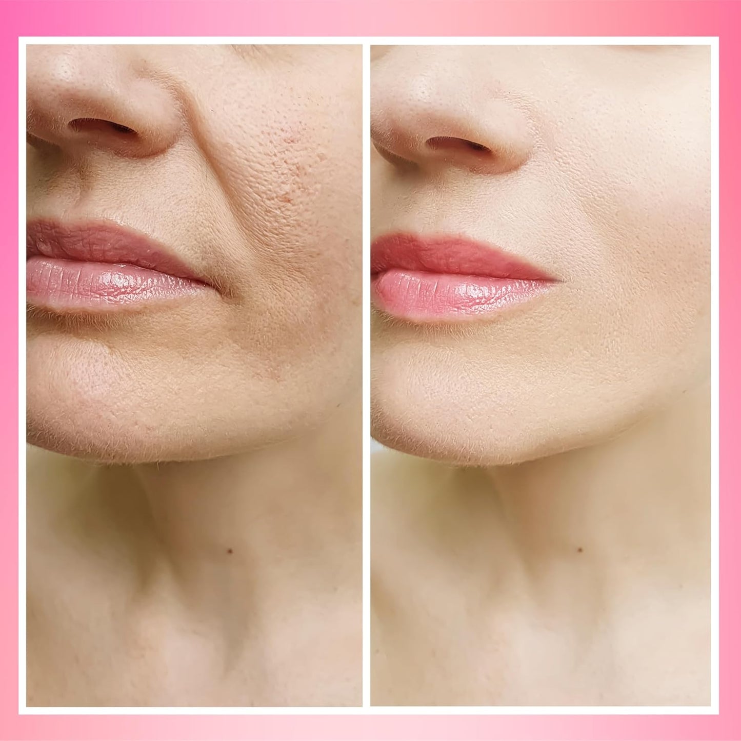 Snail Mucin 97% Daily Moisturizer (100 ml) – Hydrate, Repair & Glow