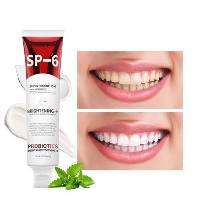 SP-6 Probiotic Whitening Toothpaste – Fresh Breath & Oral Balance
